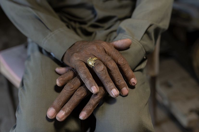 Closeup of Amar Singh's weathered hands, including an amputated index finger on his left hand.