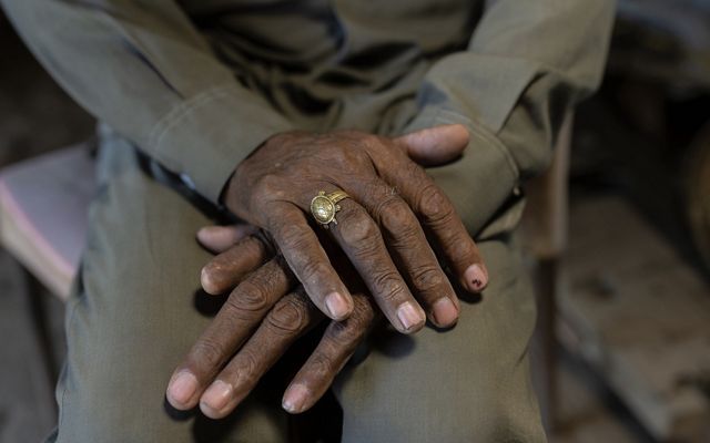 Closeup of Amar Singh's weathered hands, including an amputated index finger on his right hand.