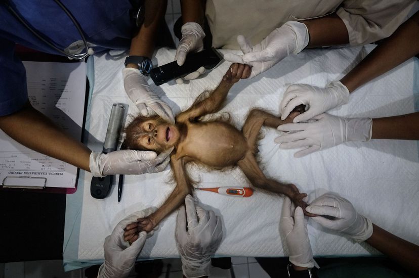 Una pequeña orangután yace en una camilla con las extremidades estiradas mientras la preparan para una operación. Está rodeada por varios pares de manos con guantes médicos y diversos dispositivos.