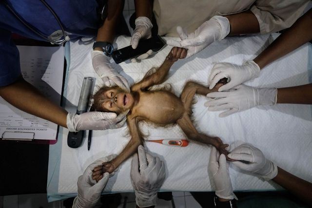seen from above, a small baby orangutan lies on its back on an operating table. many gloved hands reach out to hold it